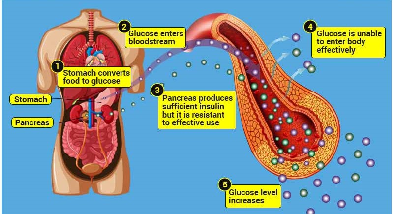 0diabeties001-1